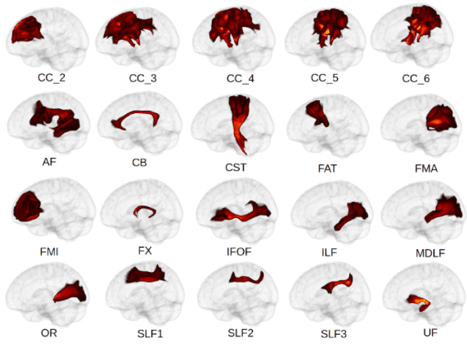 3D tractography visualization