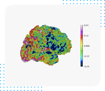 Alzheimer - Resting fMRI seed-based connectivity measures