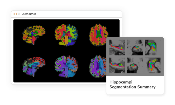 Alzheimer-Biomarker-Markeptplace-Tools