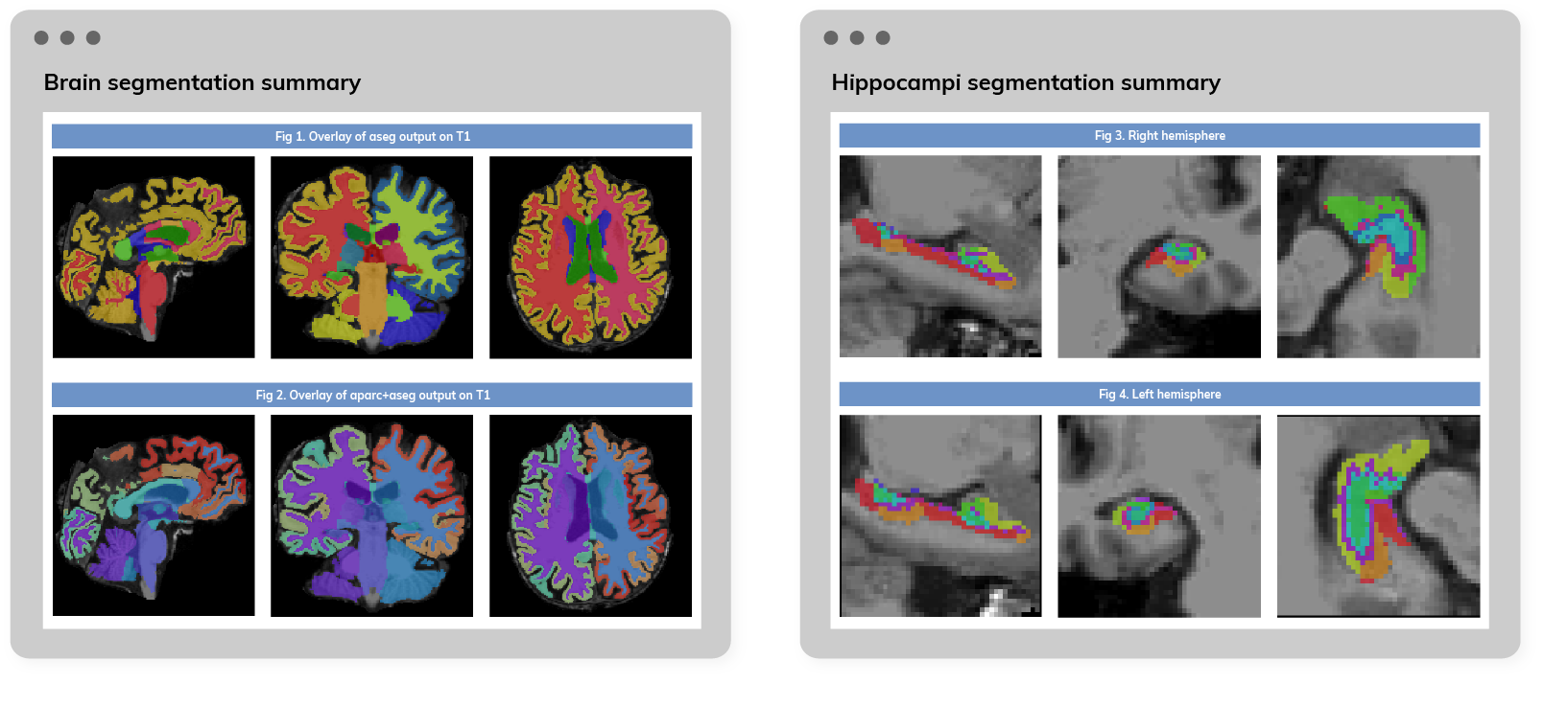 AI Neuroimaging Diseases Packages