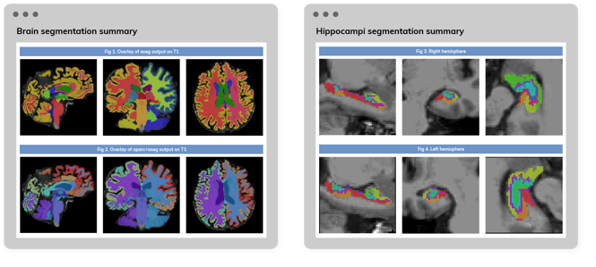 Alzheimer Imaging Biomarkers