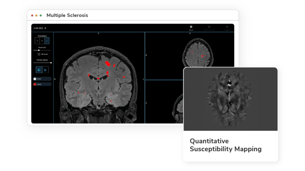 Multiple-Sclerosis-Tools-Biomarkers-Marketplace