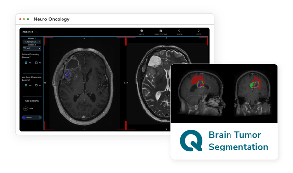 Neuro-Oncology-Biomarker-Markeptplace-Tools Neuro-Oncology-Biomarker-Markeptplace-Tools