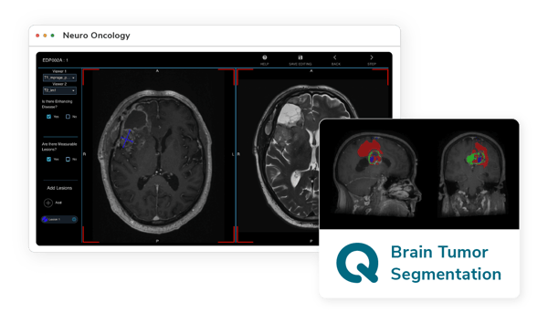 Neuro-Oncology-Biomarker-Markeptplace-Tools