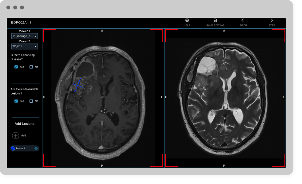 AI Neuroimaging Diseases Packages