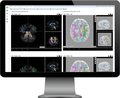 Neuroimaging-software-data-management Neuroimaging-software-data-management