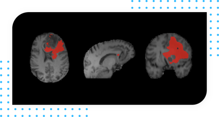 Oncology - Radiomics-