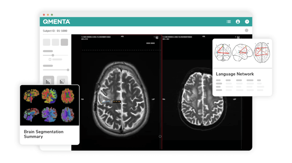 User-interface-QMENTA-Packages User-interface-QMENTA-Packages