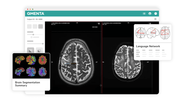 User-interface-QMENTA-Packages