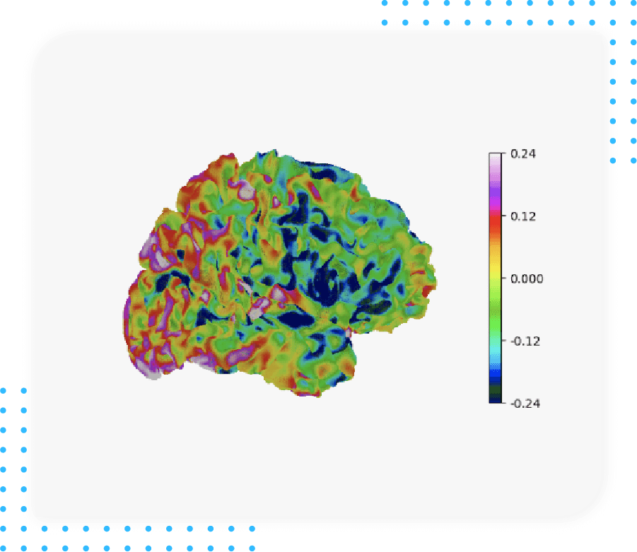 Alzheimer - Resting fMRI seed-based connectivity measures