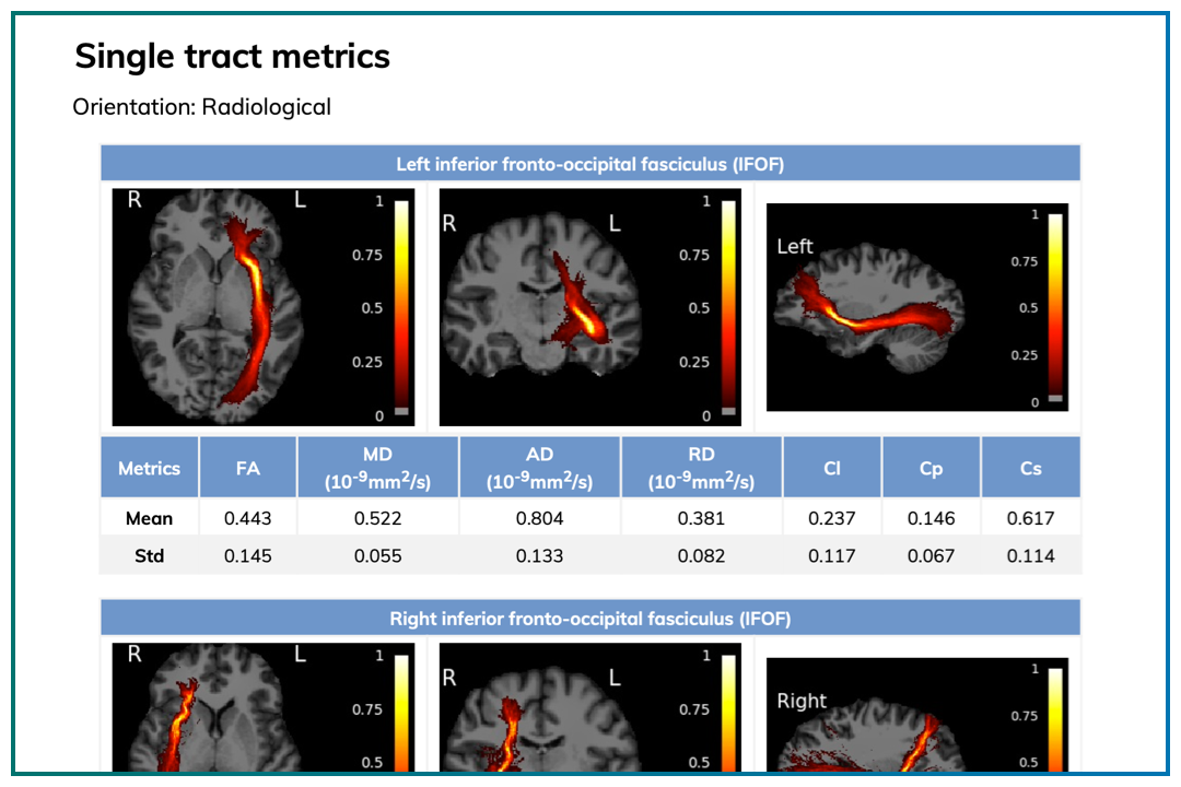 Easily Validate Your Own Advanced Biomarkers or Use Our Library of Neurological Disease AI Biomarker Tools