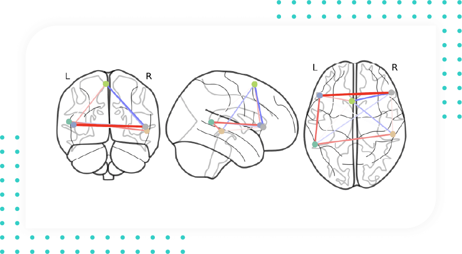 Neuropsychiatric - Patterns of Whole Brain Structural Connectivity