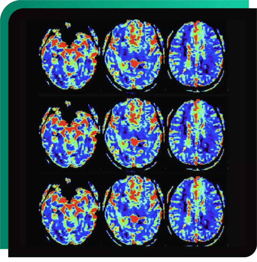 Oncology - IB Neuro-