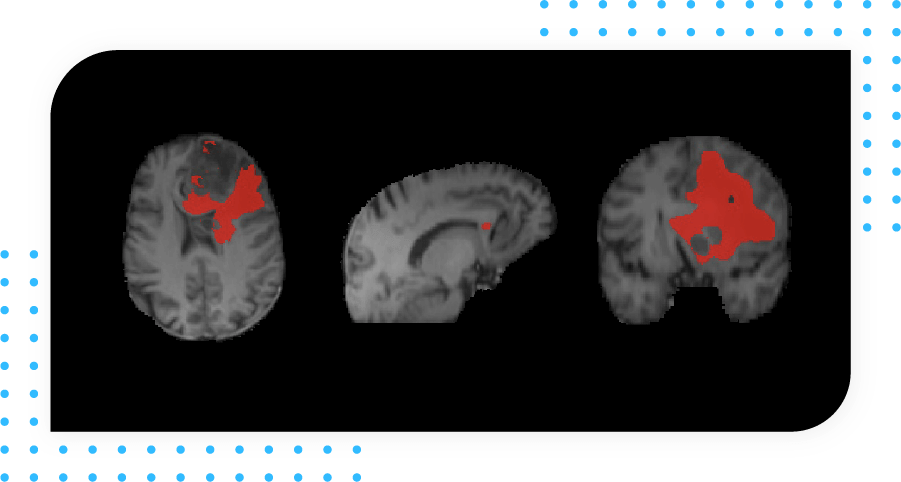 Oncology - Radiomics-