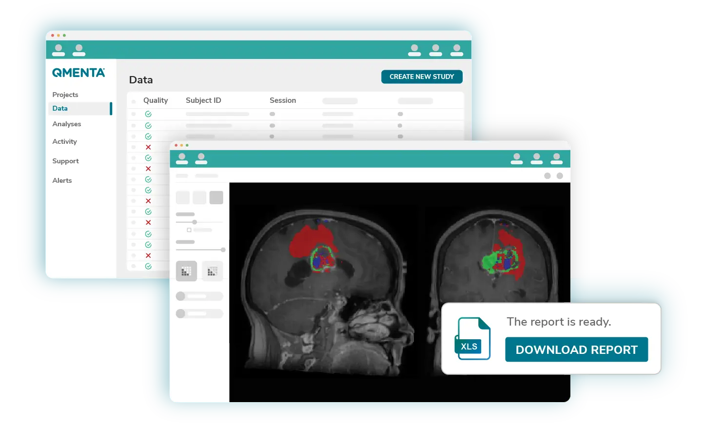 QMENTA-Platform-Download-Report-Tumor