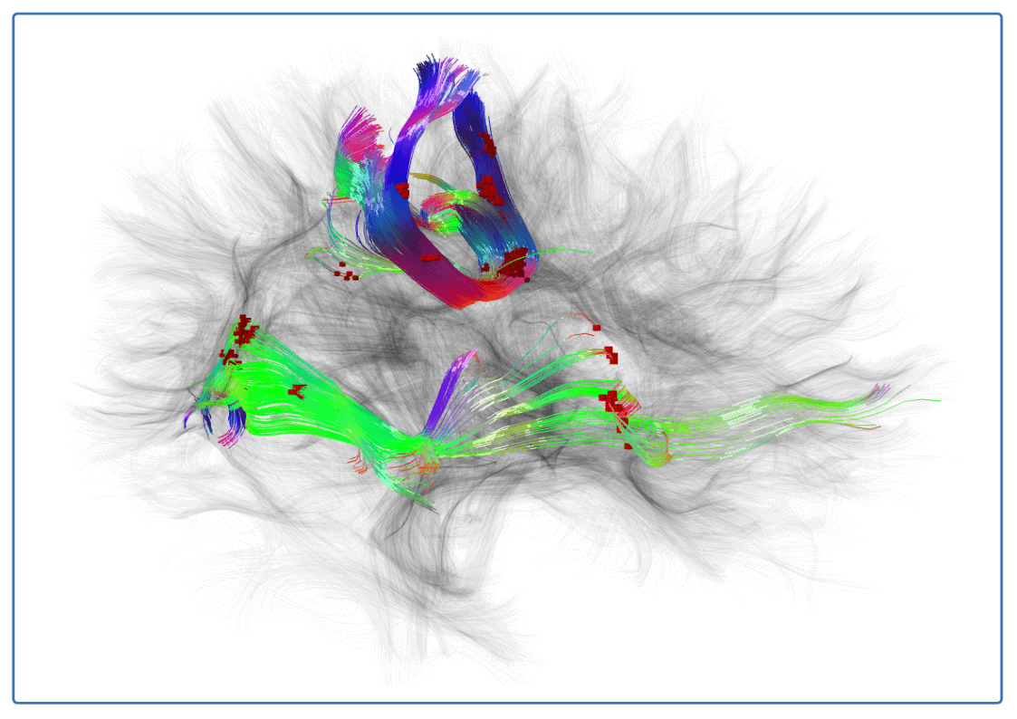 Simply and easily organize, classify, annotate and compliantly store your unstructured neuroimaging and associated data sets.