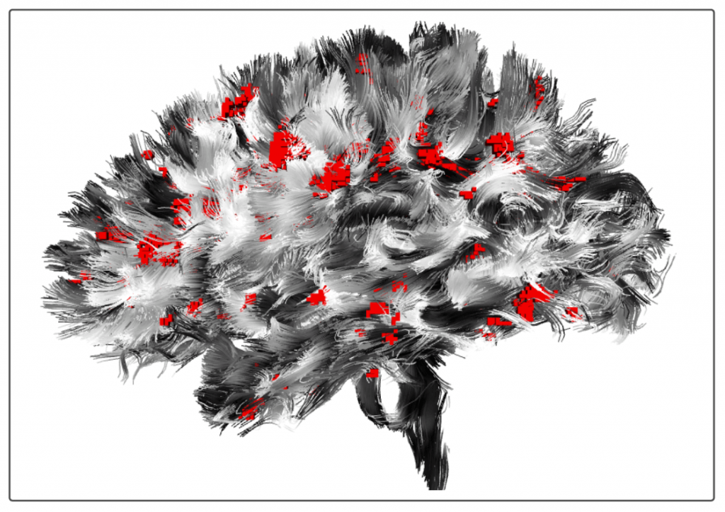 Simply and easily organize, classify, annotate and compliantly store your unstructured neuroimaging and associated data sets.
