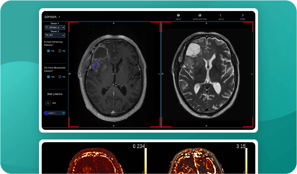 neuro-oncology-pack