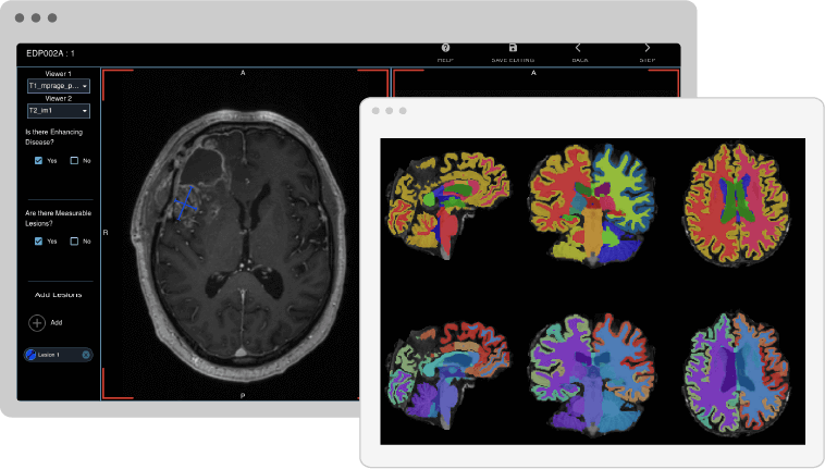 Imaging Biomarkers Marketplace